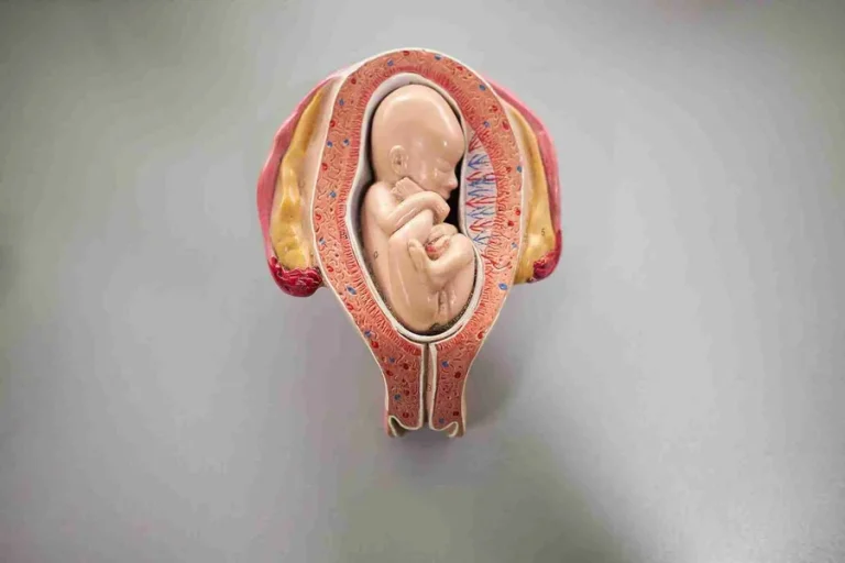 Anterior Placenta